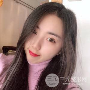 自体脂肪填充全脸恢复记录