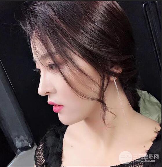 珠海陆达彭剑隆鼻整形术前术后对比