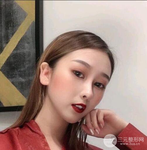 三亚三仁于德印肋软骨隆鼻+硅胶垫下巴恢复对比图