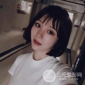 全切双眼皮半个月恢复全记录