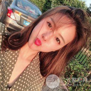 自体脂肪面部填充恢复自然果图