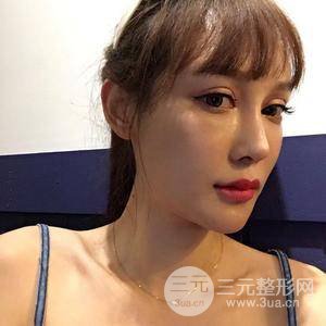 吴晓辰的自体脂肪面部填充+隆鼻整形日记