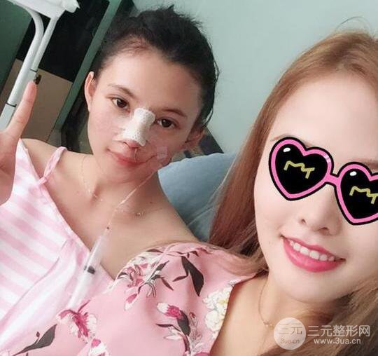 妹子做了隆鼻整形后竟变混血脸，来看看像baby还是娜扎