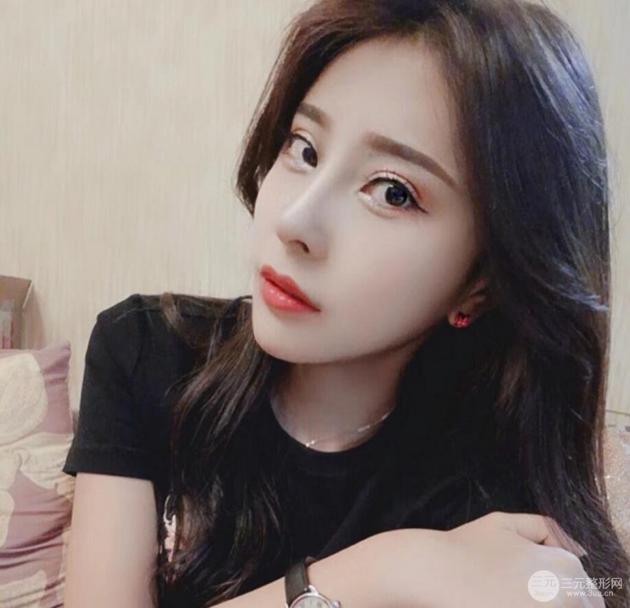 青岛海伦整形朱洪涛肋软骨隆鼻恢复记录