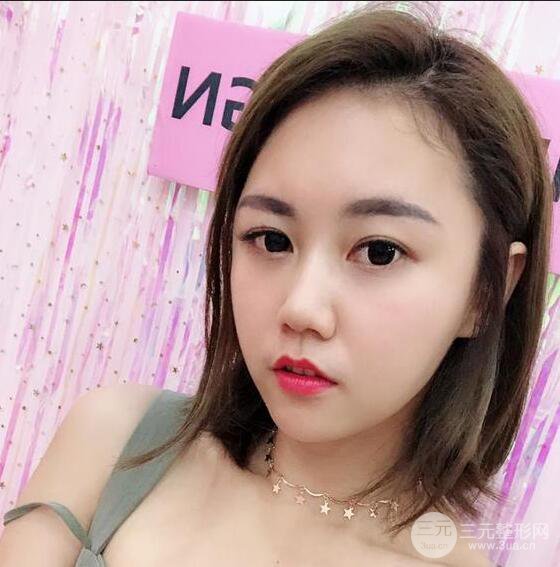 泉州亿星闵英俊磨骨恢复图分享