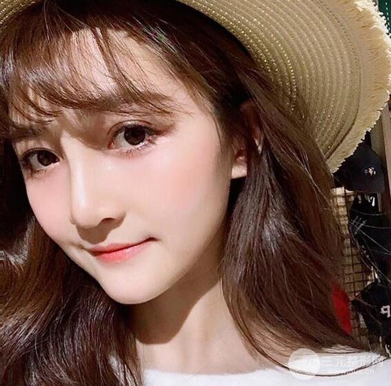 自体脂肪填充面部恢复记录，年轻十岁不是梦