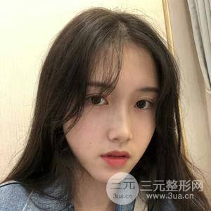 北京艺星仇侃敏肋软骨隆鼻真实果对比图