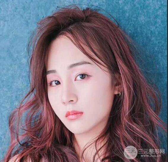 洛阳爱尚医疗美容王廷金隆鼻整形果图，恢复后有点像张钧甯