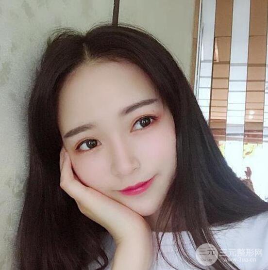 银川崔大夫博士丽医疗美容朱杰膨体隆鼻果反馈