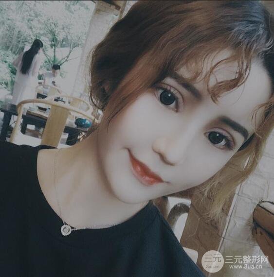 原来我和baby的距离只差一个网红套餐，“双眼皮+自体脂肪填充+丰唇”术后真人反馈