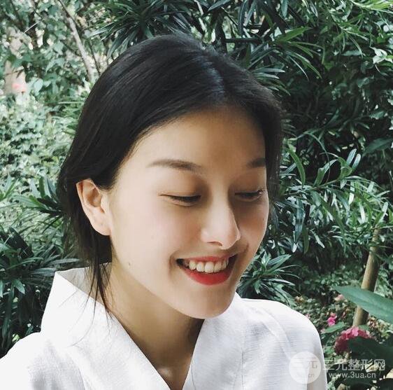 做了“埋埋蛋白线.提升+隆鼻整形”，恢复后老公说很没有降低风险感