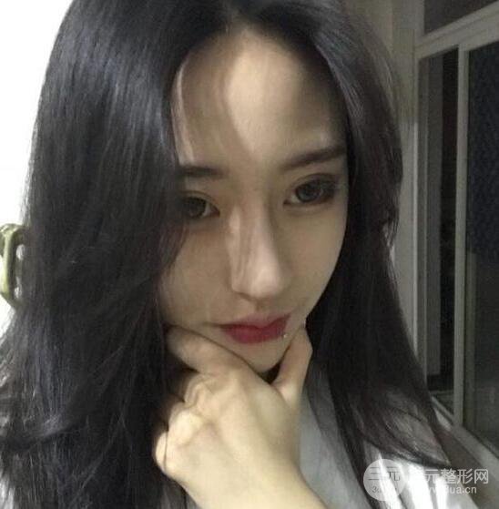 河南中医药大学第(一)附属医院赵绛波做磨骨怎么样？看看这位小姐姐的蜕变叭！