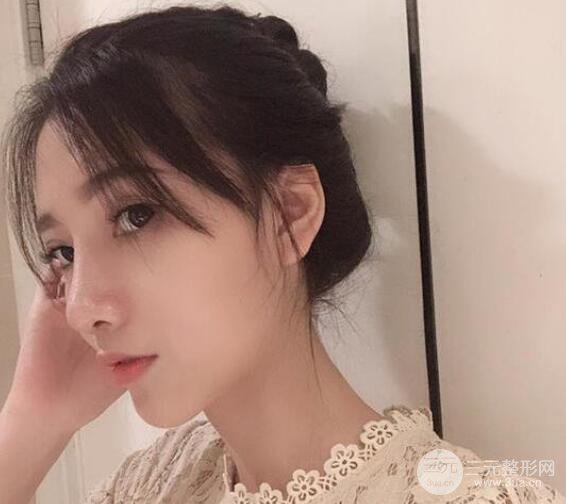 隆鼻整形手术三个月后真人果图