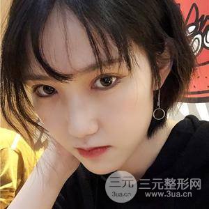 双眼皮三个月果恢复图