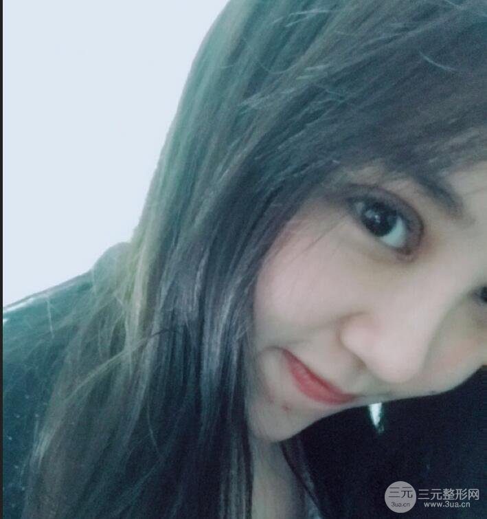 苏州芘丽芙华美孙培灵全切双眼皮真人恢复图曝光