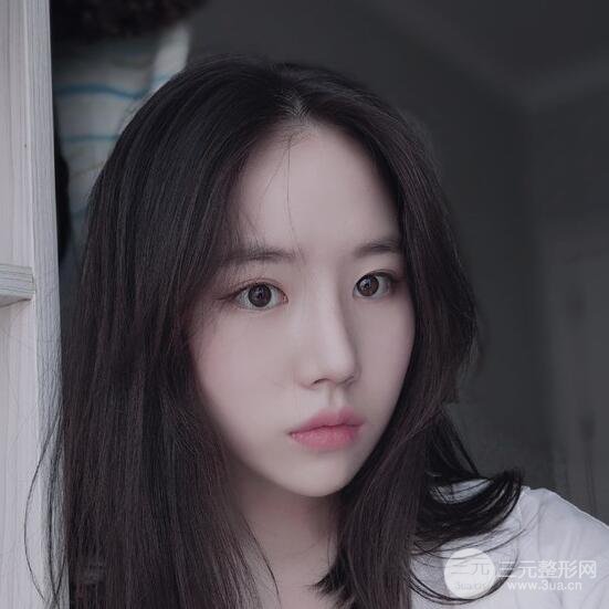 上海华美医疗美容李庭勋膨体隆鼻怎么样？果对比图
