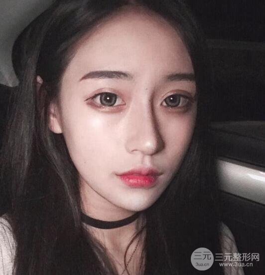 河南中医药大学第(一)附属医院赵绛波做磨骨怎么样？看看这位小姐姐的蜕变叭！