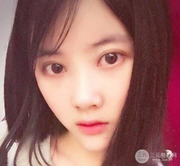 垫下巴恢复日记