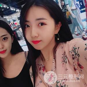 自体脂肪填充全脸恢复记录