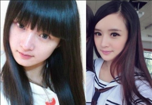 陈丹婷整容前旧照曝光，鼻子整形，磨骨对比图