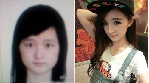 陈丹婷整容前旧照曝光,整形前后对比图