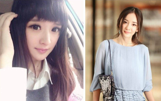 眼睛整形手术，陈丹婷整容前旧照曝光