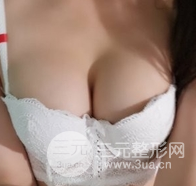 自体脂肪隆胸恢复图曝光，见证从A到C的蜕变