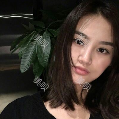 美圣美医院任志伟为我做的自体脂肪面部填充恢复过程