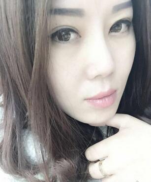 双眼皮恢复记录 果很满意~