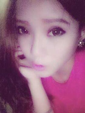 割双眼皮半个月了 有双眼皮的感觉真爽！