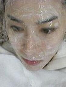 光子嫩肤 我的皮肤也可以白皙Q弹啦~