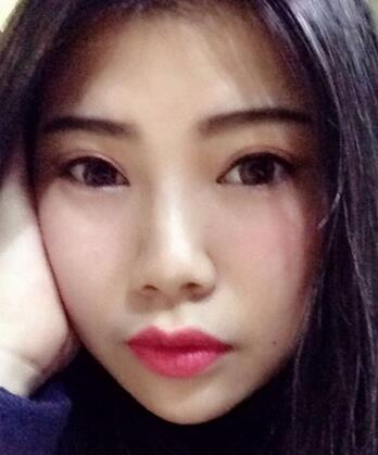 全切双眼皮后 走向女神之路