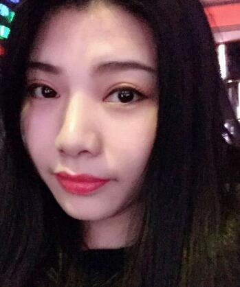 全切双眼皮后 走向女神之路