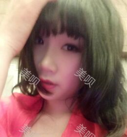 做了切开双眼皮之后气质都不一样了