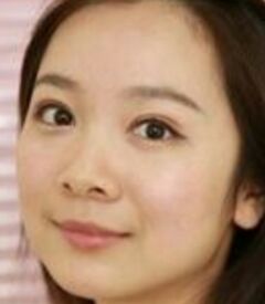 全切双眼皮让我眼睛变得更大更有神