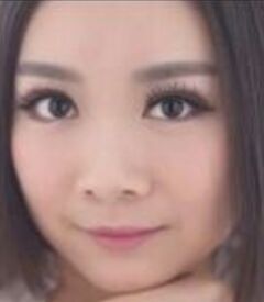 全切双眼皮让我眼睛变得更大更有神