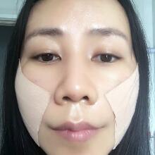 面b提升手术价格和真人案例