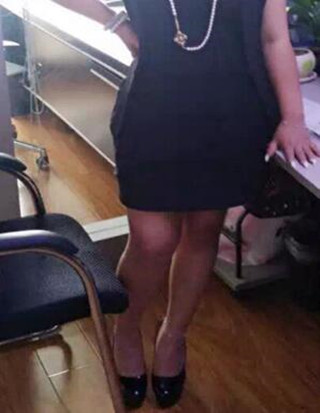 给你们分享丽都医生做的吸脂瘦腰腹