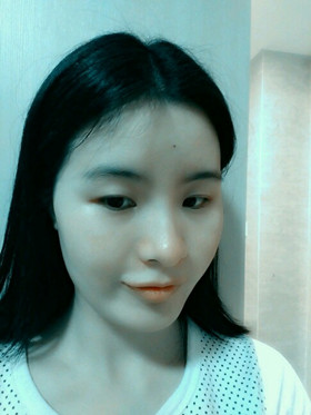 自体脂肪填充下巴前后对比图，进来看看就知道啦!