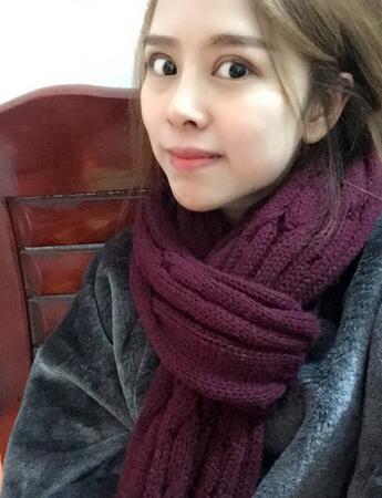 切开双眼皮恢复过程 心路分享~