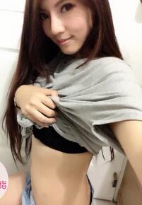 腰腹吸脂 让我告别海马腰