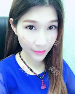 在广州缔妍做了内切去眼袋后年轻多了