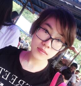 埋埋蛋白线.提升后皮肤紧致了不少也更年轻了