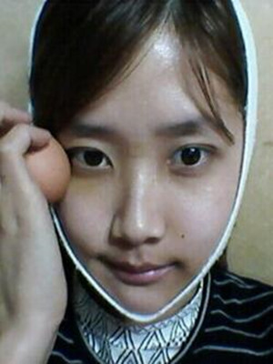 终于做了下颌角磨骨的手术 北京艺星做的 果还不错