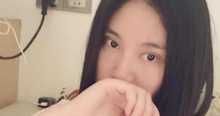 双眼皮已经半个月啦，闭上眼睛几乎没有看到疤痕