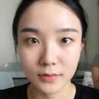 割双眼皮+开内眼角整形经历分享给大家