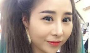 隆鼻后果图