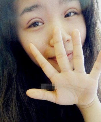 你们来看看艺美门智和做的埋线双眼皮，瞬间变大眼美女