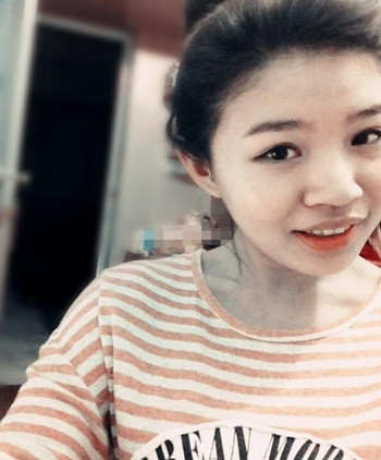 你们来看看艺美门智和做的埋线双眼皮，瞬间变大眼美女