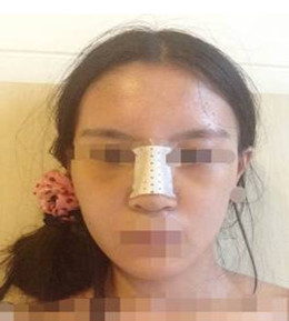 艺美门智和综合隆鼻，你值得拥有